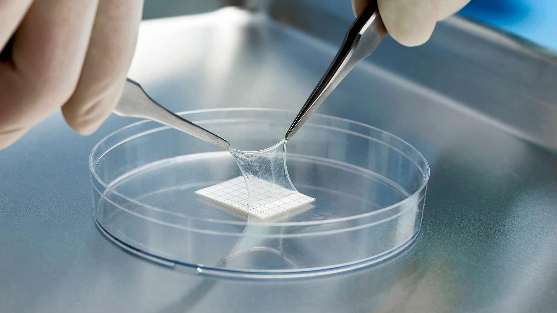 Amniotic Products Market Overview 2025 | Regional Overview, Analysis, and Future Outlook