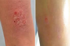 Breast Imaging Market Insights: Growth Drivers, Size & Forecasts to 2030