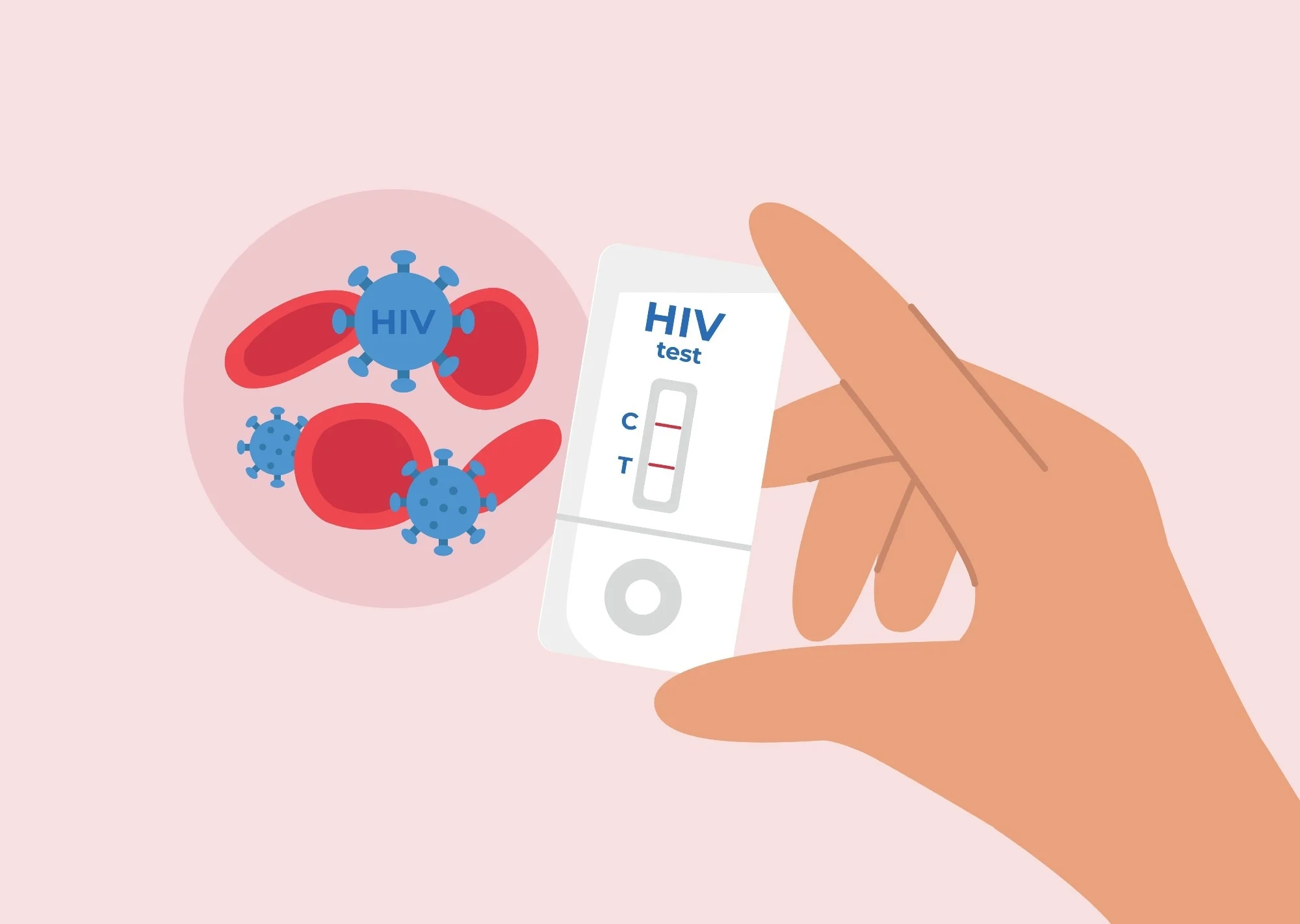 HIV Diagnostics Market Outlook 2030: Key Developments and Future Scope