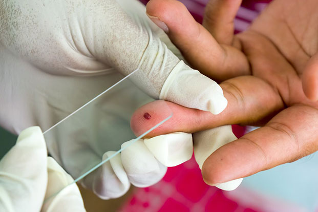 Malaria Diagnostics